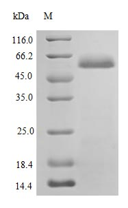 Human PDIA1 protein (Active)