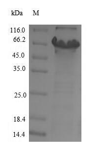 Human CYP11B2 protein