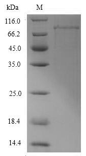 E. coli dnaK protein