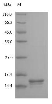 Human CD3E protein