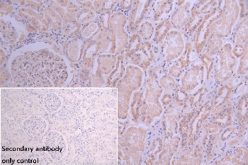 TPK1 Antibody