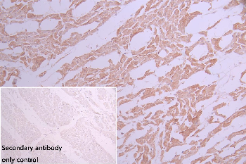 TPK1 Antibody