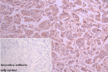 TPK1 Antibody