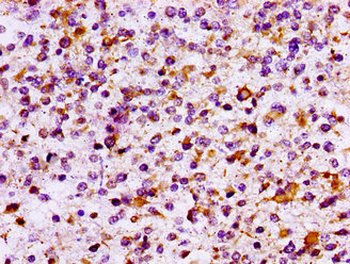 IL10RB Antibody