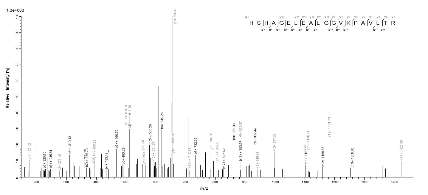 Human SLC4A1 protein