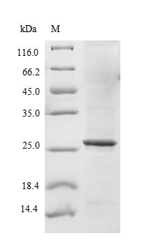 Human SLC34A2 protein