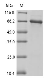 Mouse Vitamin D-binding protein