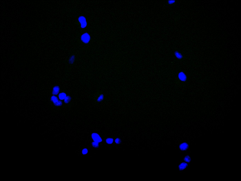 ANKRD11 Antibody