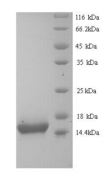 Human KRT10 protein