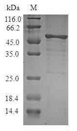 Human STK16 protein