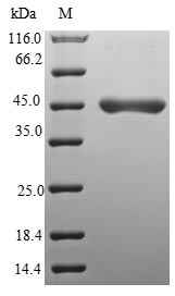 Human UBE2F protein
