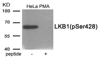 STK11 Antibody