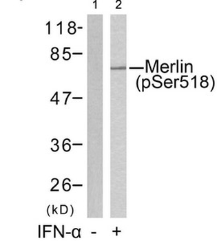 NF2 Antibody