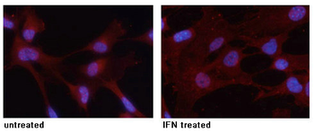 STAT3 Antibody