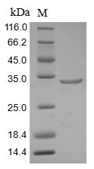 Human ARID1A protein