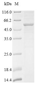 Human GBA protein