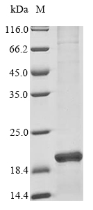 Human ISCU protein