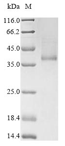 Human RHD protein