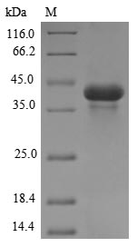 Aves Acrosin protein