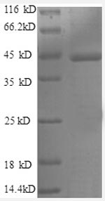 Human Caspase 1 protein