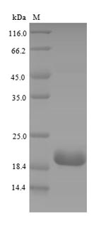 Mouse Cr2 protein