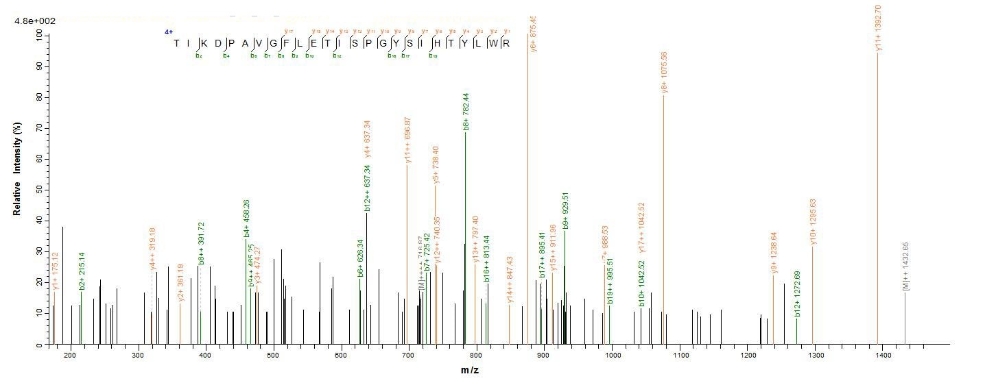 Human GBA protein