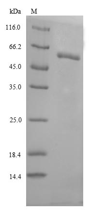 Human GBA protein
