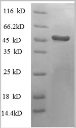 Human HNRNPH1 protein