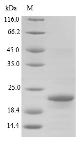 Bacteria BB3856 protein