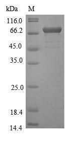 Virus Yellow fever virus Genome polyprotein protein