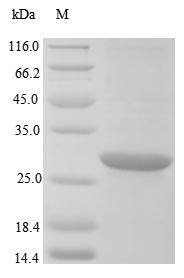Bacteria blaNDM-1 protein