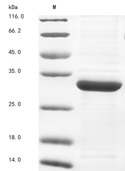 Virus Gloydius ussuriensis Thrombin-like enzyme calobin-1 protein