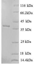 Human CANT1 protein