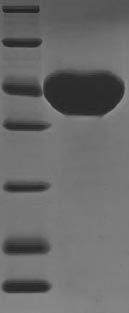 Plant Viscum album Beta-galactoside-specific lectin 1 protein