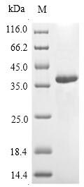 Insect Vespula vulgaris Phospholipase A1 protein