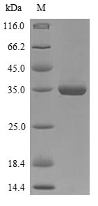 Bacteria BB3856 protein