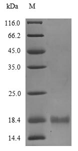 Bacteria BB3856 protein