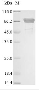 E. coli dnaK protein