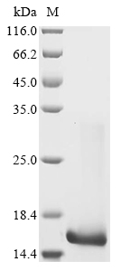 Human IL21 protein