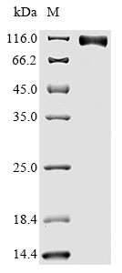 Human EGFR protein