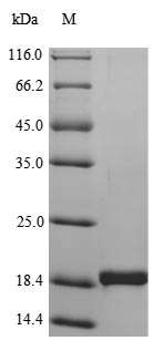 Recombinant Human Tumor necrosis factor (TNF) Protein