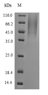Human Novel Coronavirus Nucleoprotein protein