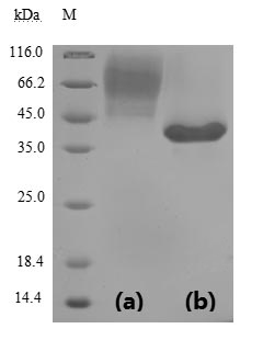 Human Novel Coronavirus Spike glycoprotein protein