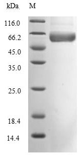 Human Novel Coronavirus Spike glycoprotein protein