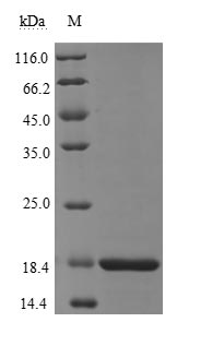 Human Novel Coronavirus Nucleoprotein(N) protein
