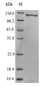 Human Novel Coronavirus Nucleoprotein(N) protein (Biotin)