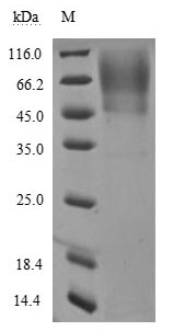 Human Novel Coronavirus Spike glycoprotein(S) protein