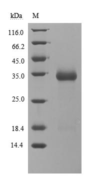 Human Novel Coronavirus Spike glycoprotein(S) protein