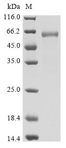 Human Novel Coronavirus Spike glycoprotein(S) protein (Biotin)
