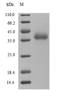 Human SARS coronavirus Spike glycoprotein(S) protein